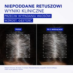 Phytocyane Intensive+ KURACJA PRZECIW POSTĘPUJĄCEMU WYPADANIU WŁOSÓW DLA KOBIET